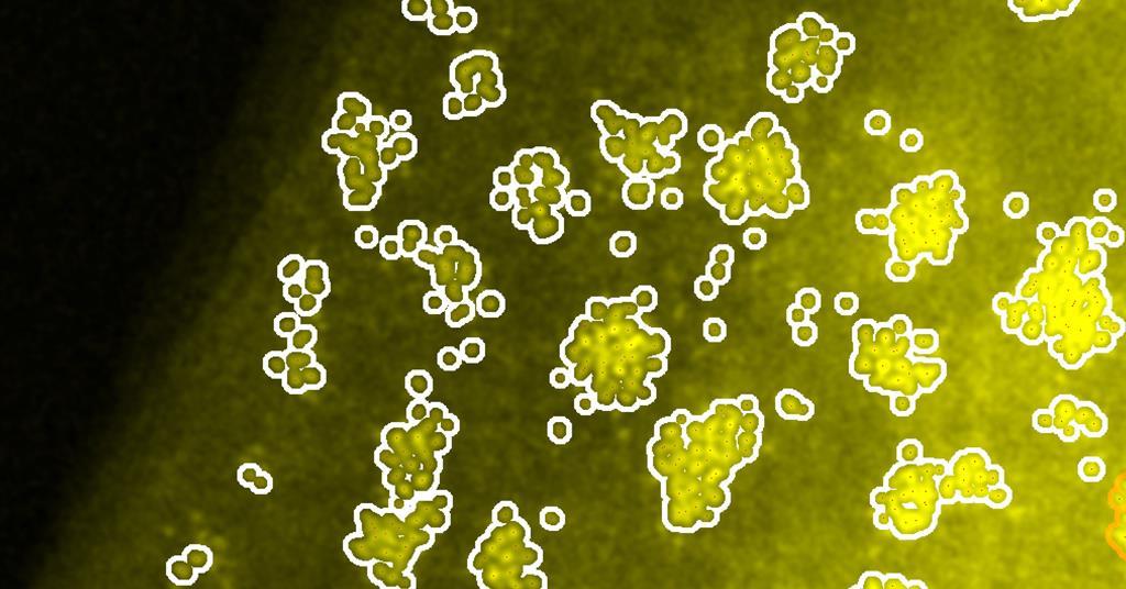 Electron microscopy reveals how ruthenium reordering boosts hydrogen manufacturing from ammonia | Evaluation